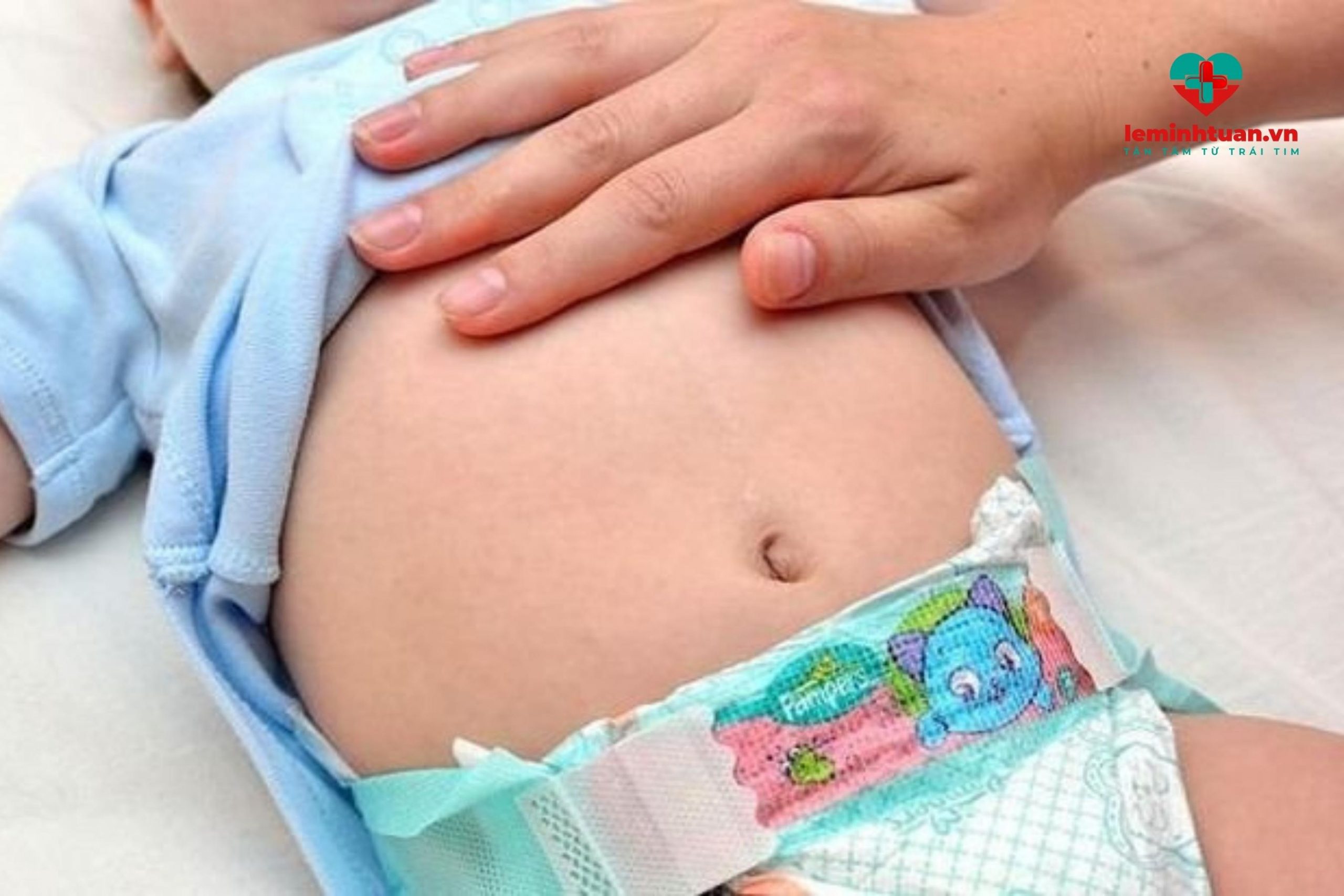 Trẻ bụng phình to sau khi ăn do bệnh lý