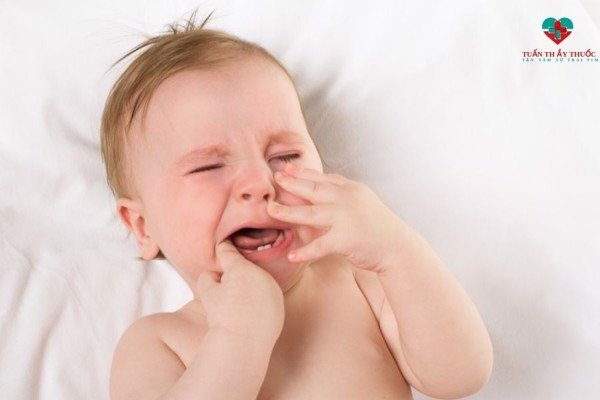 Trẻ sốt mọc răng