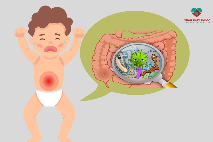 Trẻ bị đau bụng từng cơn do nhiễm khuẩn đường ruột