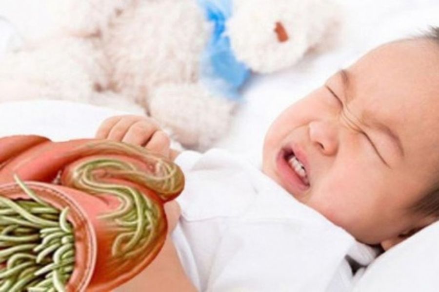 Trẻ 4 tuổi đau bụng buồn nôn do nhiễm giun sán