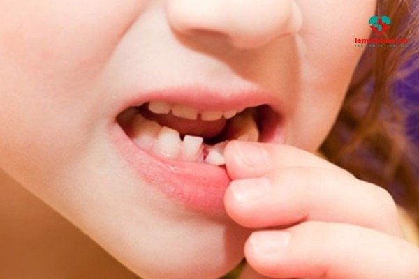 Bổ sung canxi cho trẻ thay răng