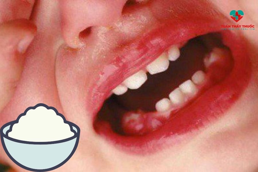 Trẻ mấy tháng ăn cơm được: tín hiệu răng miệng