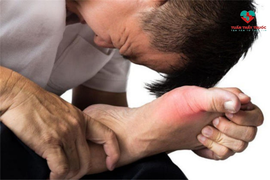 Các biện pháp giúp giảm sưng khớp ngón chân cái