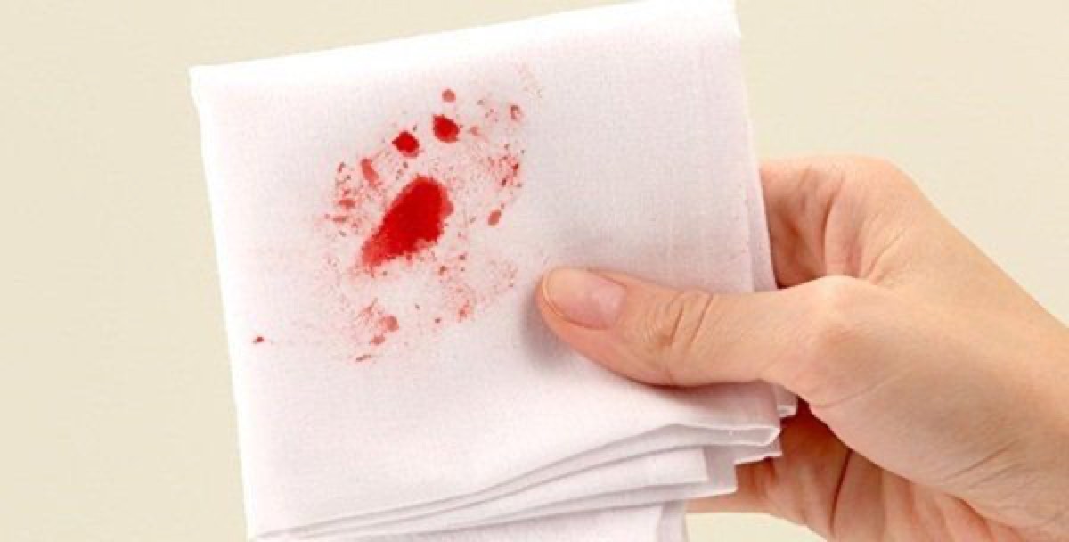 giấy có lẫn máu 1